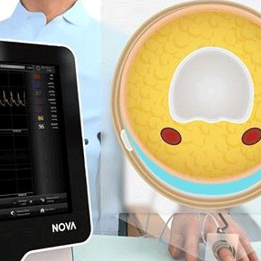 tile volume clamp method