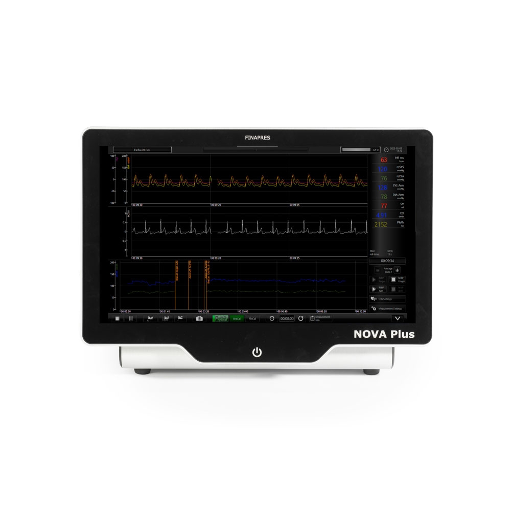 NOVA-Plus-regular-measurement-Remote-Control-software (1)