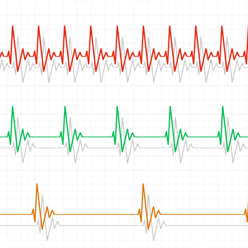 Heart Rate Variability parameters