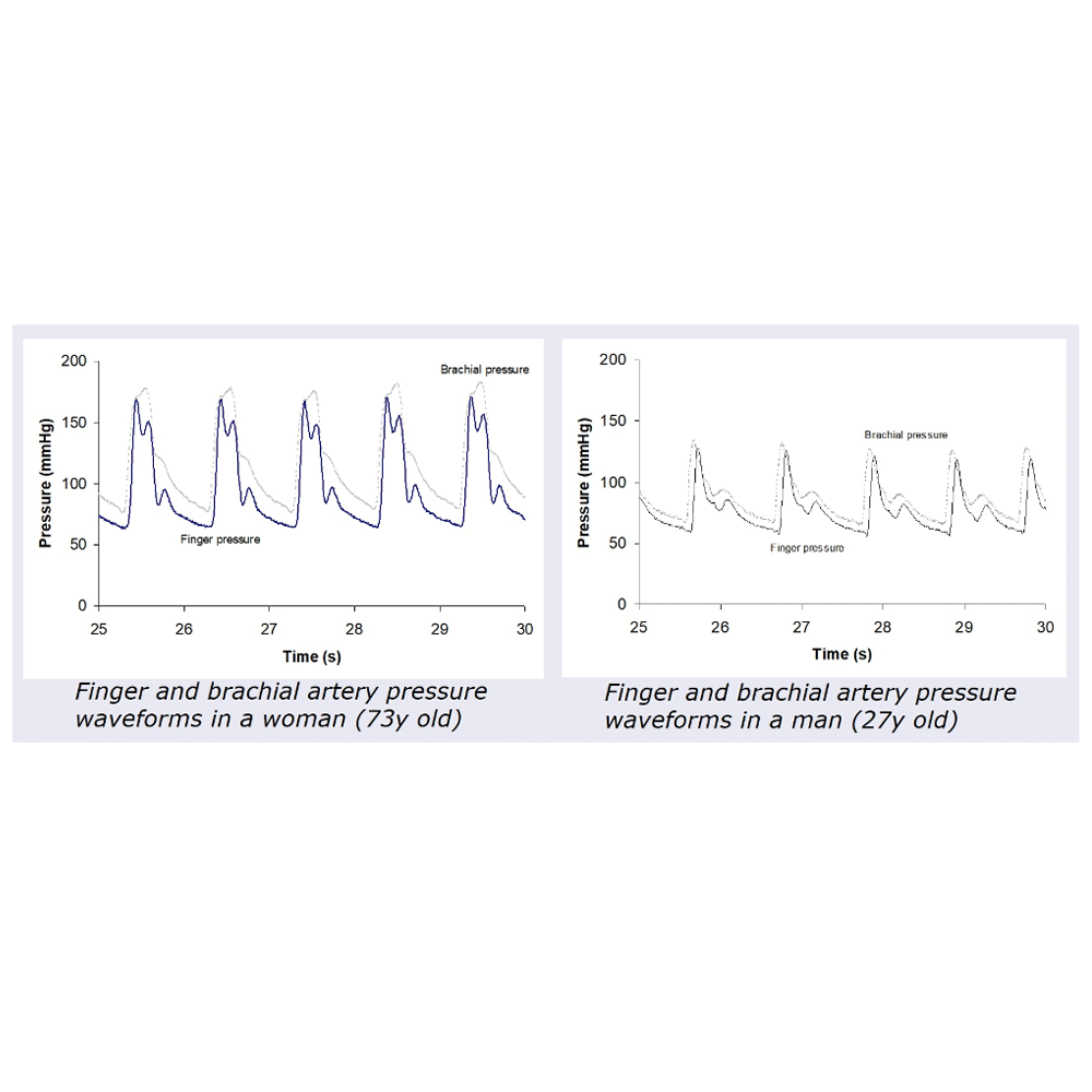 finger and brachial artery pressure